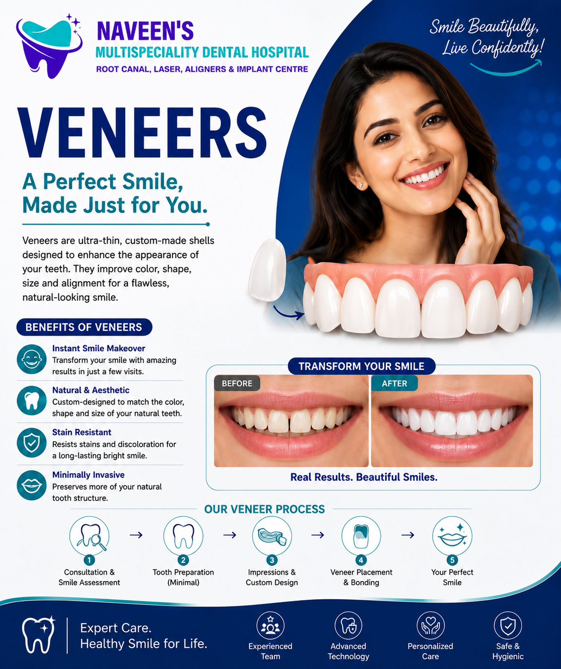 Clear Aligners