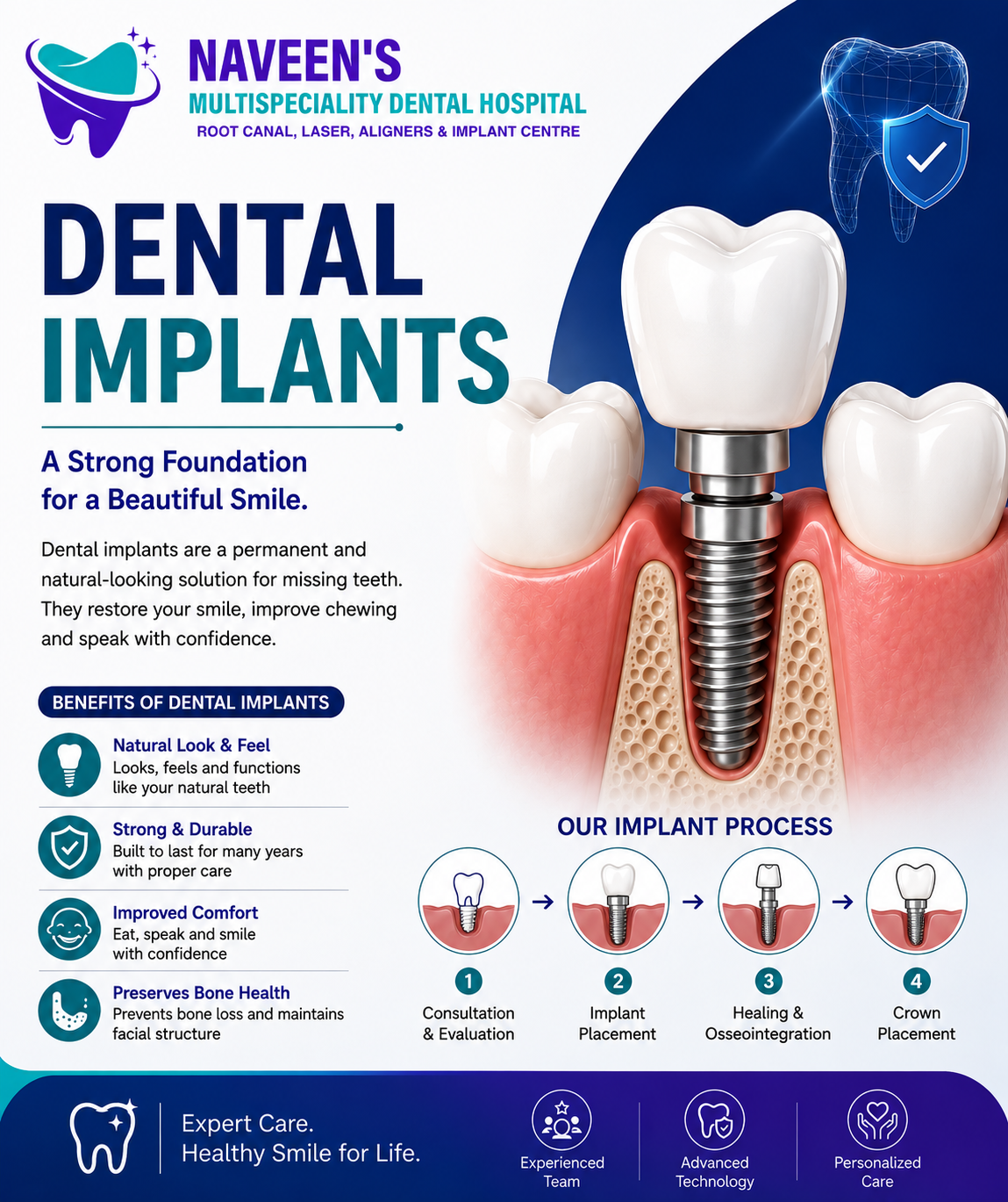 Dental Implants