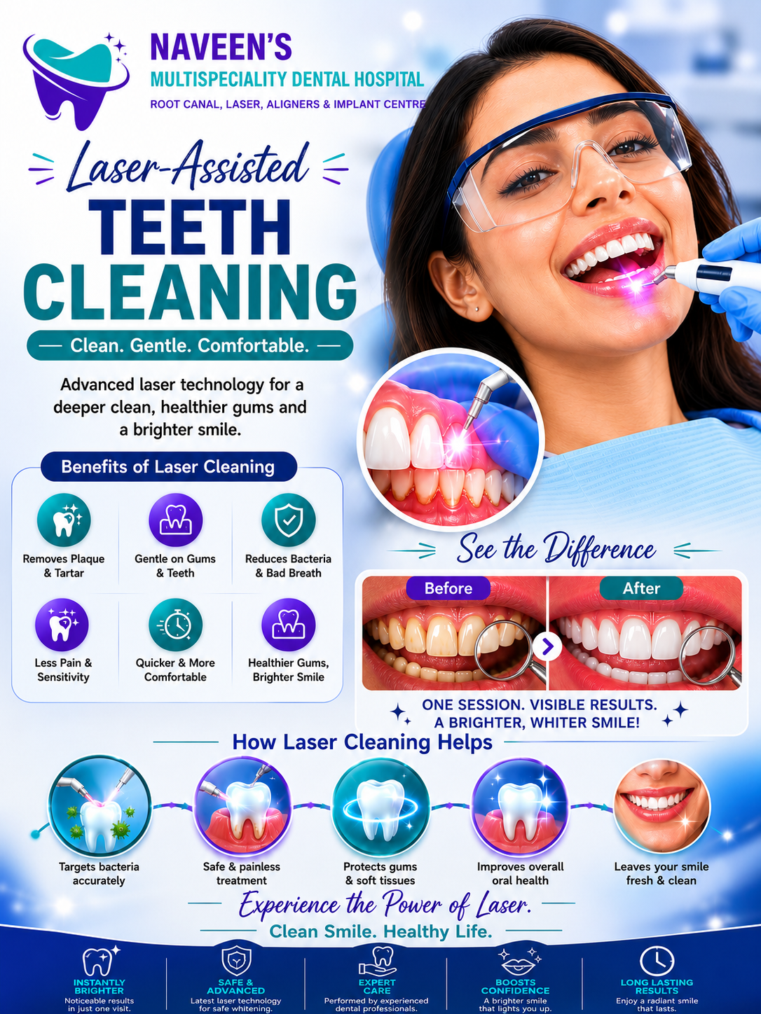 Laser-Assisted Teeth Cleaning