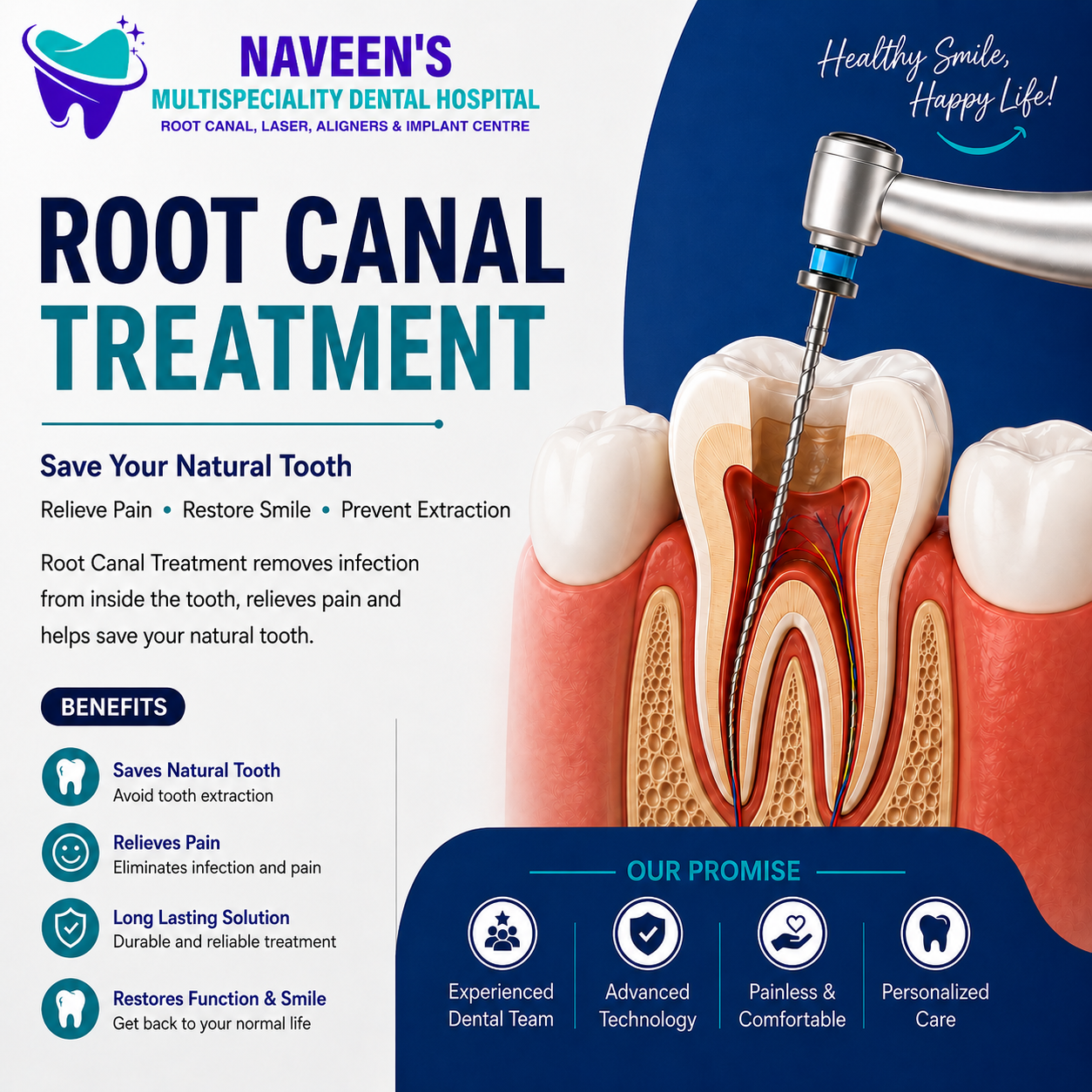Root Canal Treatment