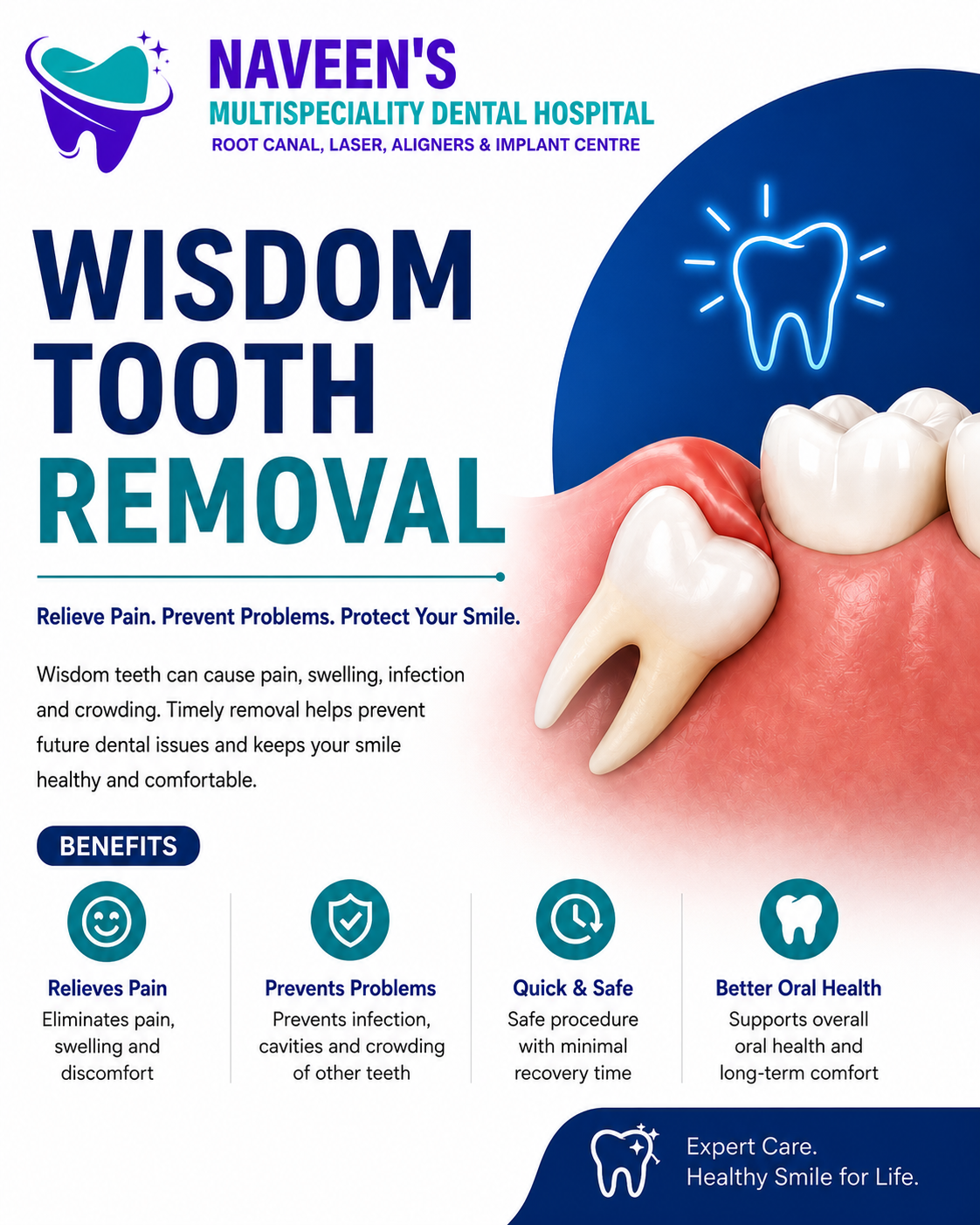 Wisdom Tooth Removal