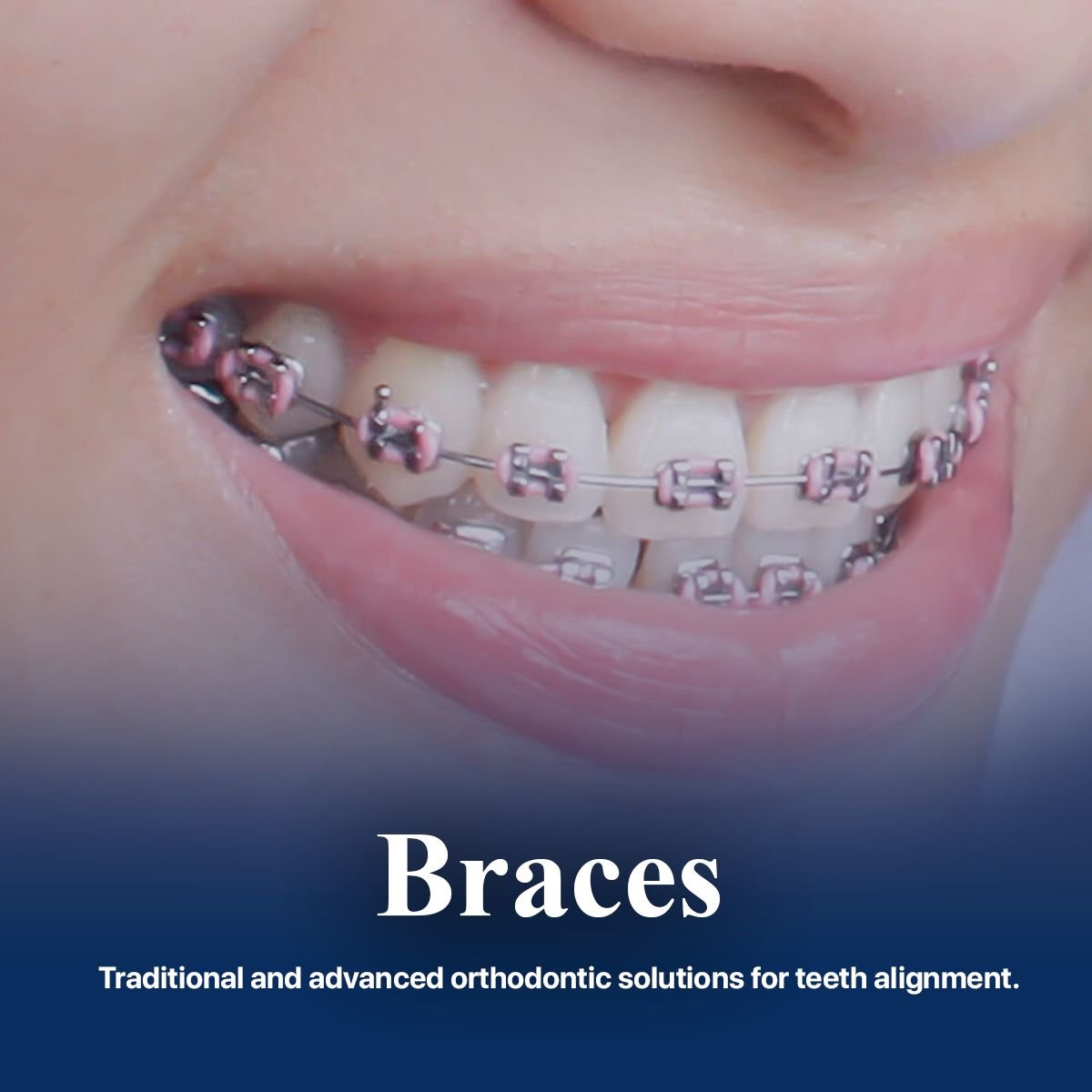 WhatsApp Image 2025-01-21 at 21.44.08